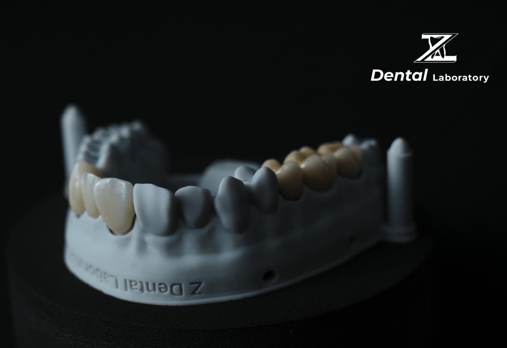 Zirconia dental ceramics