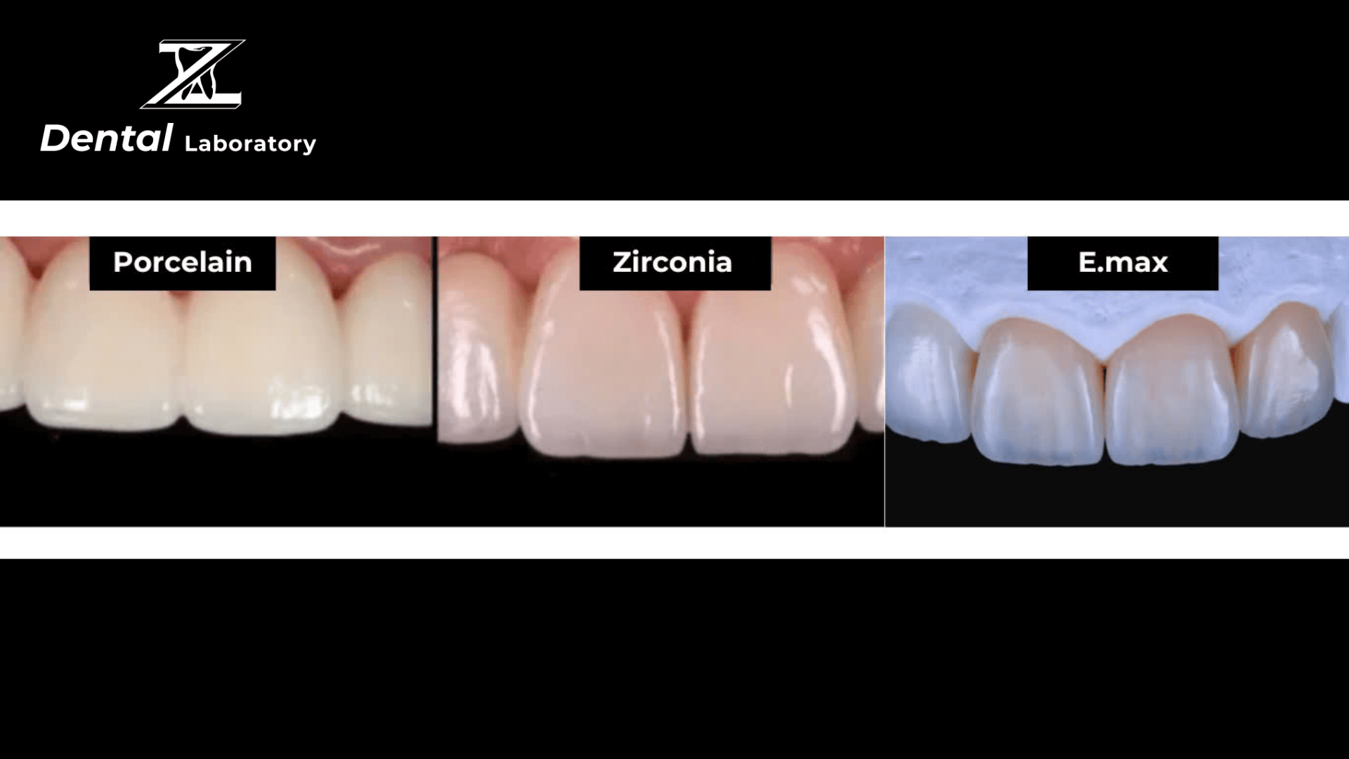 A Complete Guide to Ceramic Teeth Making: Techniques and Tips