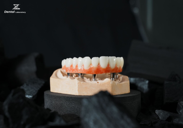 WHAT ARE DENTAL IMPLANTS?