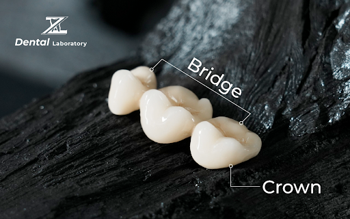 WHAT ARE DENTAL CROWNS & BRIDGES