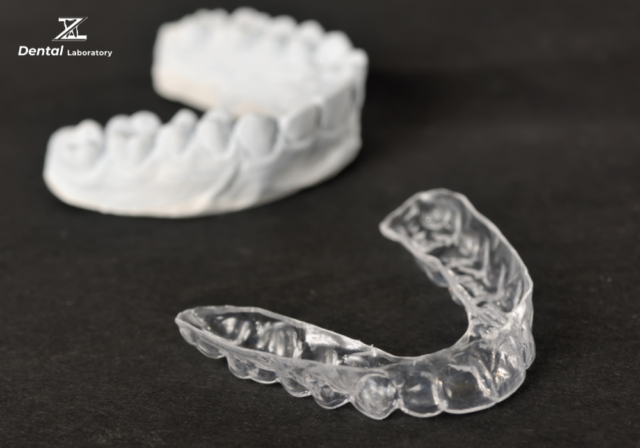 WHAT IS A DENTAL SPLINT?